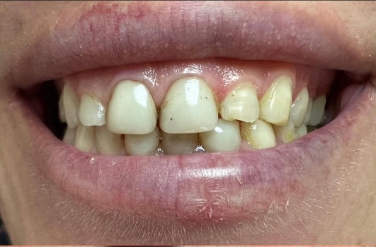 rezultate klinike dentare