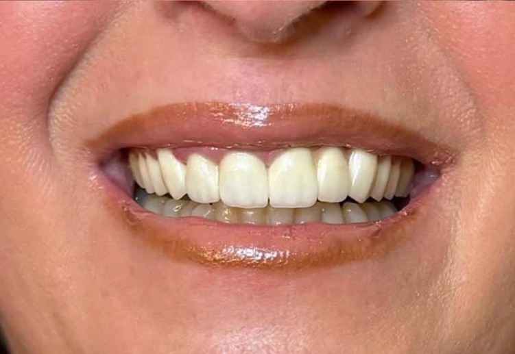 rezultate klinike dentare