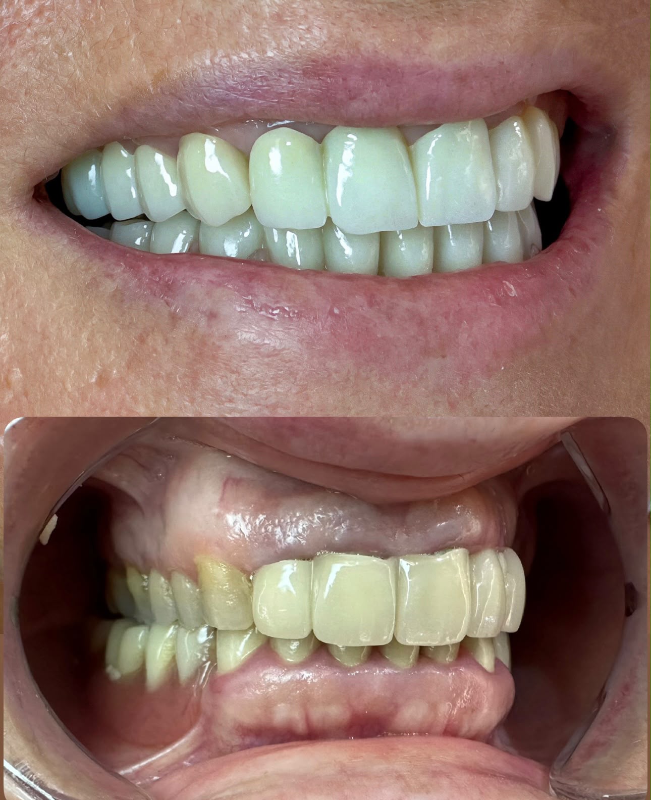 Gallery Smile 1