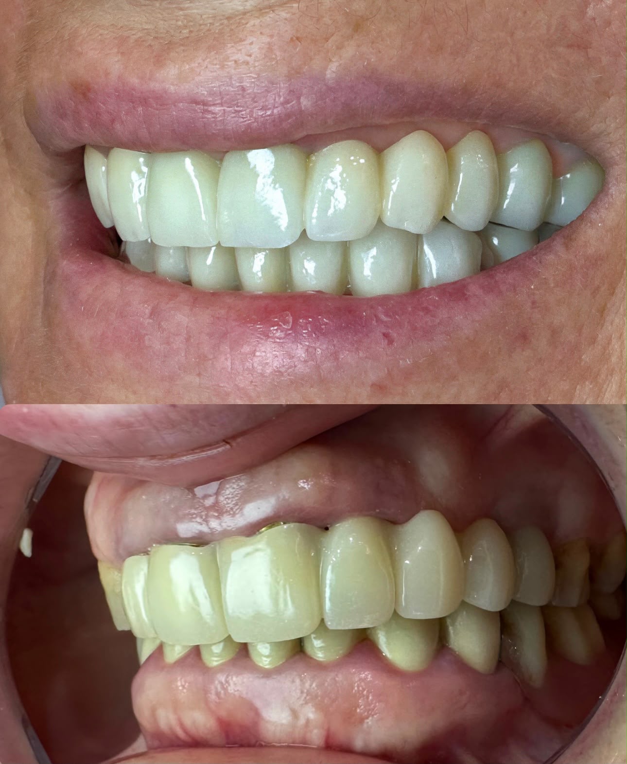 Gallery Smile 2