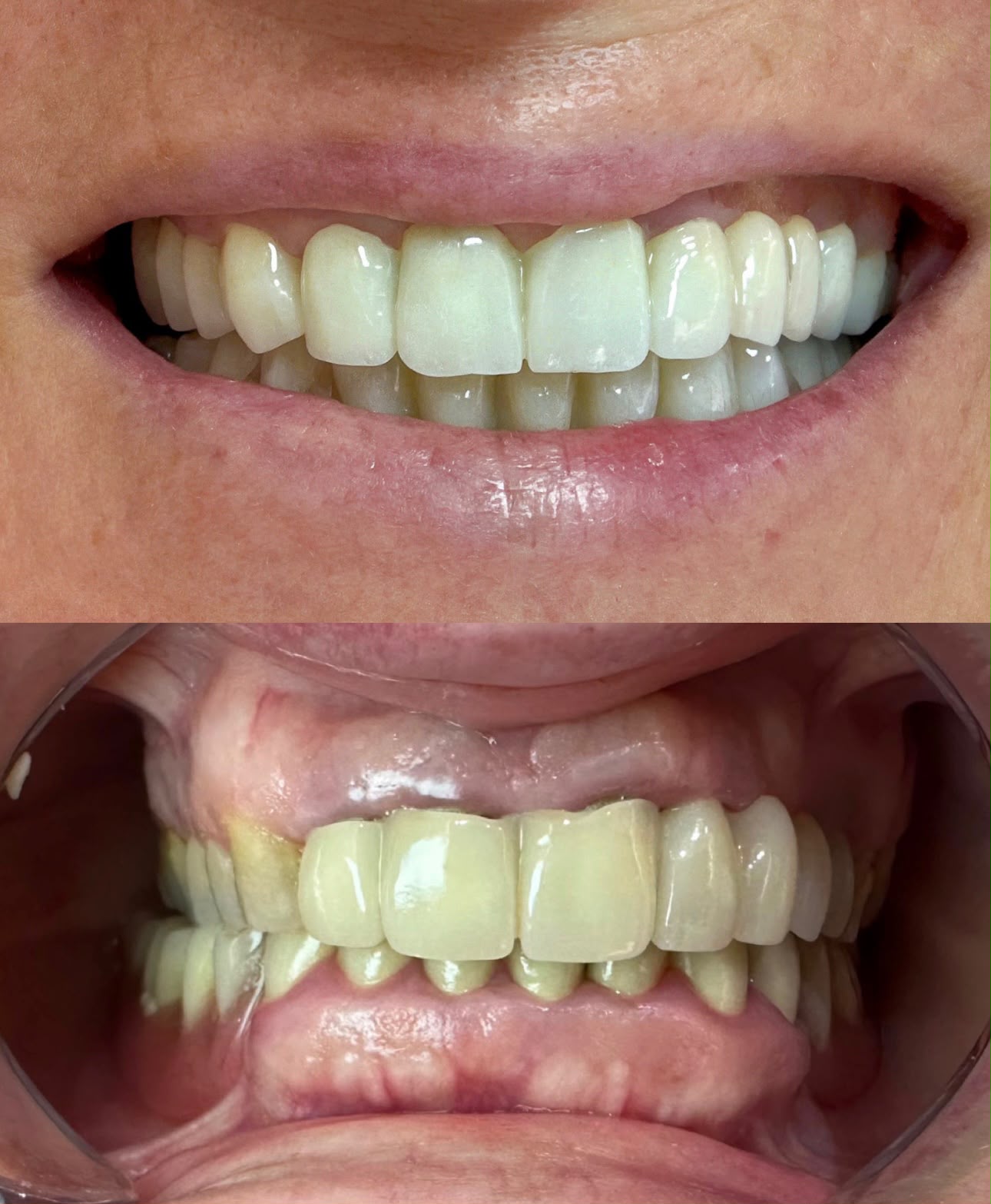 Gallery Smile 3